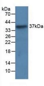LRG1 Monoclonal Antibody (C2)