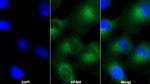 IGFBP-1 Monoclonal Antibody (D3)