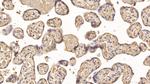 IGFBP-1 Antibody in Immunohistochemistry (Paraffin) (IHC (P))