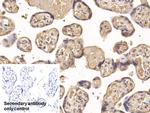 IGFBP-1 Antibody in Immunohistochemistry (Paraffin) (IHC (P))