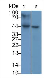 HLA-B Monoclonal Antibody (C1)