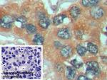 HSPA1A Antibody in Immunohistochemistry (Paraffin) (IHC (P))