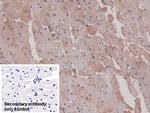 DCLK1 Antibody in Immunohistochemistry (Paraffin) (IHC (P))