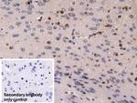 DCLK1 Antibody in Immunohistochemistry (Paraffin) (IHC (P))