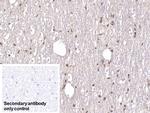 DCLK1 Antibody in Immunohistochemistry (Paraffin) (IHC (P))