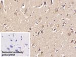 DCLK1 Antibody in Immunohistochemistry (Paraffin) (IHC (P))