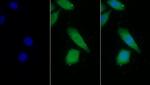 Prothrombin Fragment 1/2 Monoclonal Antibody (D1)