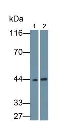 CK1 delta Antibody in Western Blot (WB)