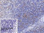 HLA-DRB1 Monoclonal Antibody (C3)