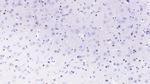 PCSK9 Monoclonal Antibody (C5)