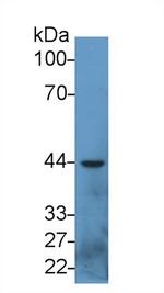 SERPINB3/SERPINB4 Monoclonal Antibody (C1)
