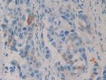 HSP27 Antibody in Immunohistochemistry (Paraffin) (IHC (P))