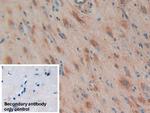 HSP27 Antibody in Immunohistochemistry (Paraffin) (IHC (P))