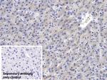 SAA Monoclonal Antibody (D5)