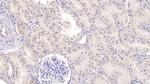 TDO2 Antibody in Immunohistochemistry (Paraffin) (IHC (P))