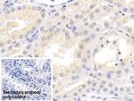 MMP7 Antibody in Immunohistochemistry (Paraffin) (IHC (P))