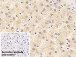 SERPINF2 Antibody in Immunohistochemistry (Paraffin) (IHC (P))