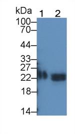 TIMP1 Monoclonal Antibody (C8)