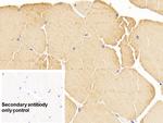 alpha-Cardiac Actin Antibody in Immunohistochemistry (Paraffin) (IHC (P))