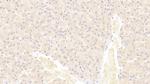 S100A9 Antibody in Immunohistochemistry (Paraffin) (IHC (P))