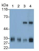 Tryptase Monoclonal Antibody (C13)