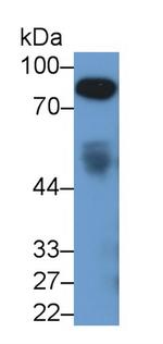 Afamin Monoclonal Antibody (C1)