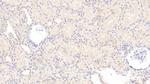 PAI1 Antibody in Immunohistochemistry (Paraffin) (IHC (P))
