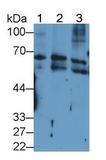 Cytokeratin 2e Monoclonal Antibody (D2)