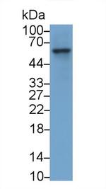 Factor IX Monoclonal Antibody (C2)
