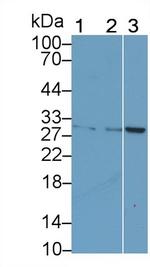 CTLA-4 Antibody in Western Blot (WB)