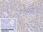 Cofilin Antibody in Immunohistochemistry (Paraffin) (IHC (P))