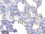 Cofilin Antibody in Immunohistochemistry (Paraffin) (IHC (P))