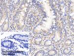Cofilin Antibody in Immunohistochemistry (Paraffin) (IHC (P))