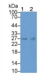 TK1 Monoclonal Antibody (C301)
