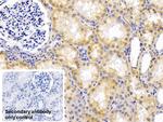 alpha-1 Antitrypsin Antibody in Immunohistochemistry (Paraffin) (IHC (P))