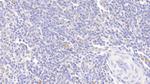 alpha-1 Antitrypsin Antibody in Immunohistochemistry (Paraffin) (IHC (P))