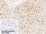 alpha-1 Antitrypsin Antibody in Immunohistochemistry (Paraffin) (IHC (P))
