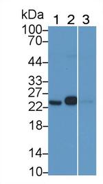 GSTP1 Monoclonal Antibody (C2)
