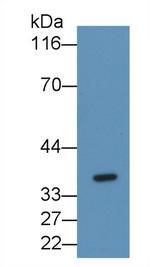 FGL1 Monoclonal Antibody (C7)