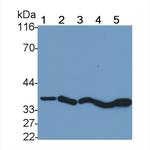Cathepsin B Monoclonal Antibody (D5)