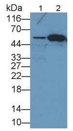 FOXP1 Monoclonal Antibody (D6)