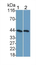 SHBG Monoclonal Antibody (H3)