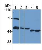 HPa1 Monoclonal Antibody (C3)