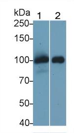 Thrombomodulin Monoclonal Antibody (H2)