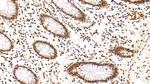HDAC1 Antibody in Immunohistochemistry (Paraffin) (IHC (P))