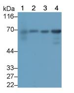PLS3 Monoclonal Antibody (C4)