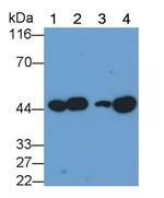VEGFC Monoclonal Antibody (C2)