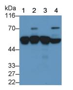 alpha-1 Antitrypsin Monoclonal Antibody (C5)