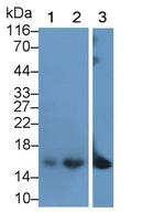CRABP2 Monoclonal Antibody (C1)