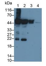 Cytokeratin 20 Monoclonal Antibody (C2)